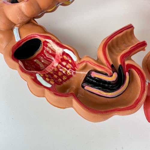 Modèle du système digestif pour illustrer vos consultations médicales - 7