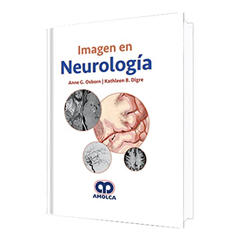 Imagen en Neurologia
