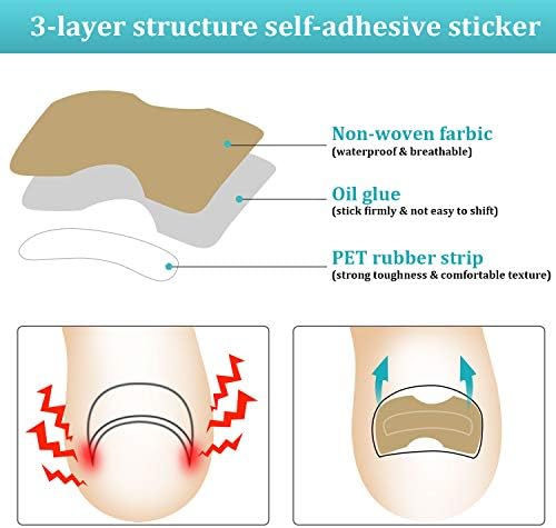 122 Pieces Ingrown Toenail Tool Set, Include Ingrown Toenail File and Lifter, 60 Pieces Elastic Patch Curved Toenails Brace Stickers and 60 Pieces Ingrown Toenail Correction Stickers