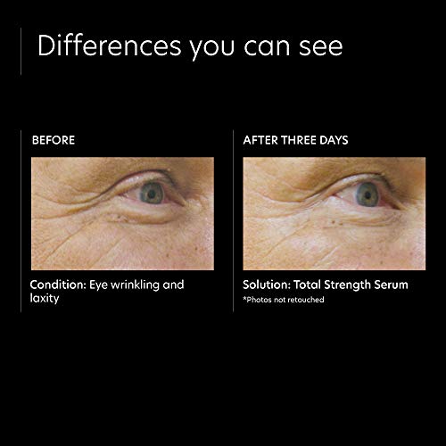 Pca Skin Total Strength Face Serum - Anti Aging Hydrating Treatment With Epidermal Growth Factors & Peptides, Minimizes Pores, Fine Lines & Wrinkles (1 Fl Oz) #TOP3