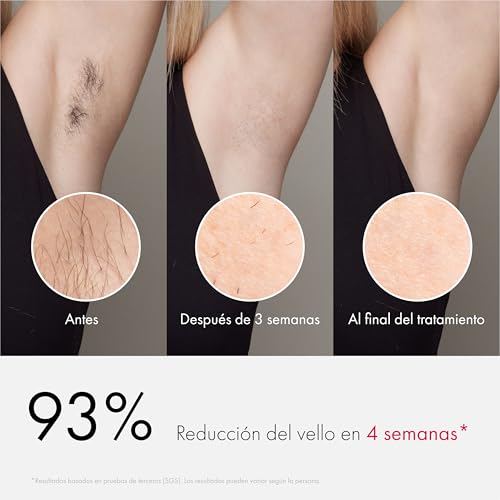 Ulike Air 3 Deluxe – Depiladora Luz Pulsada para Mujer y Hombre, Resultados Prácticamente Indoloros, Alternativa a la Depilación Láser, con Esterilizador UV y Gel de Aloe - imagen 3