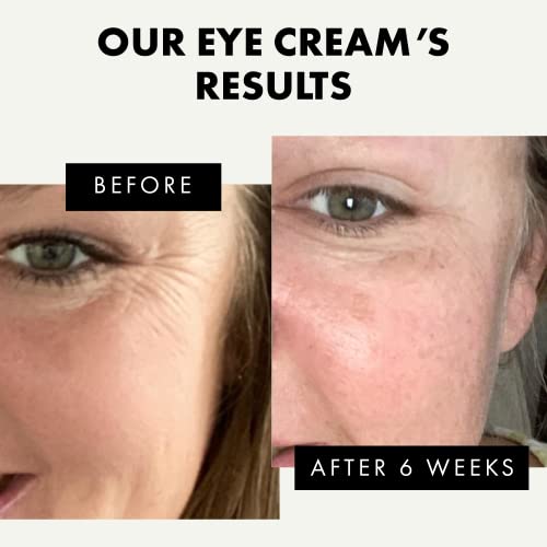 Organic Eye Cream For Dark Circles And Puffiness, Under Eye Treatment W/ Vitamin E, Eye Bags Treatment For Men & Women, Eye Cream For Anti Aging & Wrinkles With Soothing Oat Extract, Ha & Antioxidants #TOP2