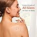 TKTK 443 Count Pimple Patches for Face, Hydrocolloid Acne Patch Bulk, Acne Stickers for Covering Cheeks, Forehead, Chin Blemishes Zit Breakouts for All Skin Types (Dots, Strip, Contoured 5 Sizes)
