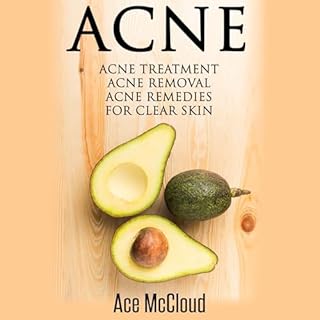 Acne: Acne Treatment cover art