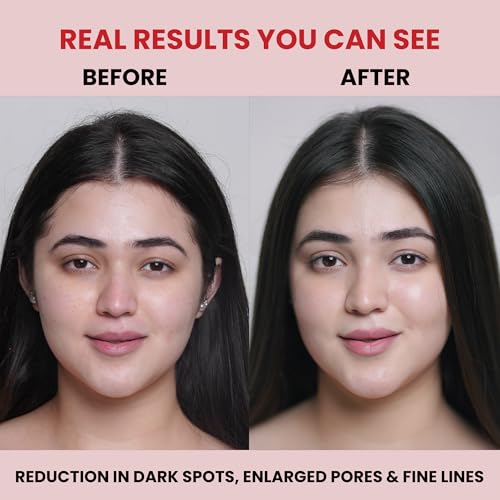 Image of Carbamide Forte Bio Collagen Mask | Collagen Mask Overnight | Sheet Mask | Korean Glass Skin Overnight Hydrogel Face Mask Sheets for Deep Hydration, Pore Minimizing, Firming & Moisturizing | Paraben-Free | For All Skin Types | 1 Piece - 35g