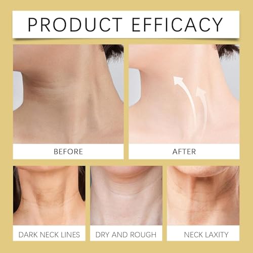 AH-8 Firming Neck Cream, 120g AH-8 Hals Straffende Cremes Roller, Firming Neck Cream zur Reduzierung von Falten,Halslinien & Schlaffer Haut