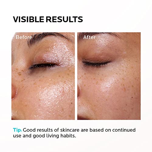 Zealsea Oil-Free 2% Salicylic Acid Cleanser Bha Exfoliant For Face Aha Pore Cleansing Acne Wash Gel Facial Cleanser Helps Reduces Breakouts And With Oily Skin Control For Sensitive Skin (8.45Oz) #TOP5