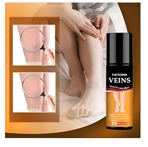 Image of Original Varicose Veins Relief Spray (30ml) - Natural Herbal Formula to Reduce Leg Pain & Swelling | Improves Blood Circulation for Tired Legs & Ankles | Fast-Acting & Easy to Use (Pack of 1)