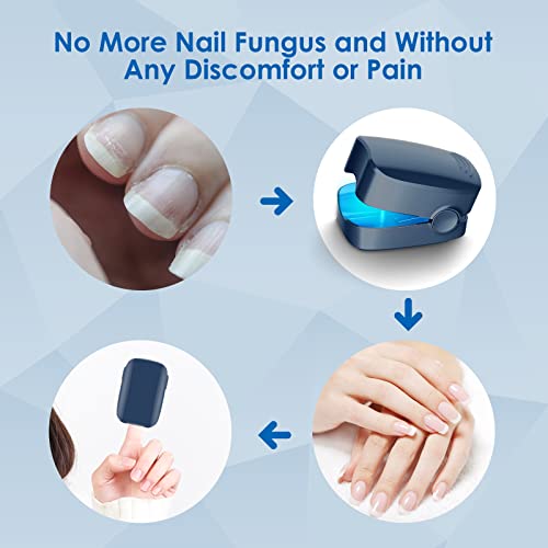 Nail Fungus Laser Led Light, Light Therapy #TOP4