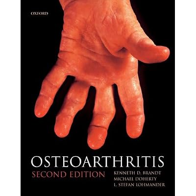 Osteoarthritis