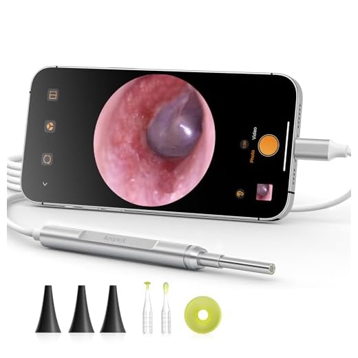 Anykit Digital Otoscope for iPhone, iPad & Android Device, Ultra Clear View Ear Camera with Ear Wax Removal Tools, Video Ear Scope Otoscope with Light, Support Capture Photo & Record Videos