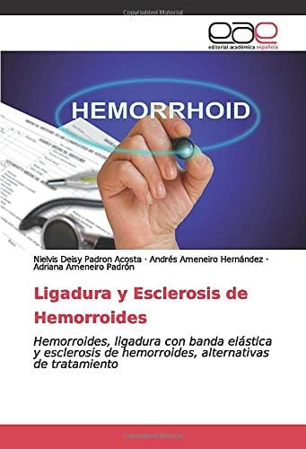 Ligadura y Esclerosis de Hemorroides: Hemorroides, ligadura con banda elástica y esclerosis de hemorroides, alternativas de tratamiento