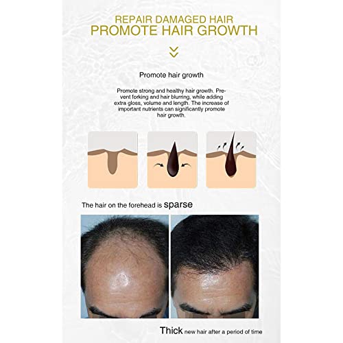 Rosemary-Essential-Oils-Rosemary-Oil-For-Hair-Growth-Onion-Rosemary-Oil-Dry-Damaged-Hair-Growth-Hair-Scalp-Oil-Rosemary-Oil-For-Hair-Growth-Spray-Supplement-Men