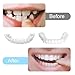 2 Pairs of Smile Supports Can Be Adjusted Freely Suitable for All Adults, and Smile Quickly and Confidently (Up and Down)
