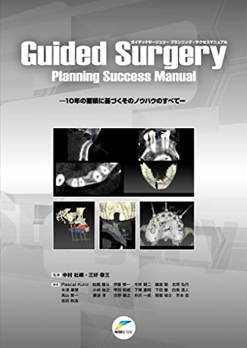 無料電子書籍 アプリ Guided Surgery Planning Success Manual―10年の蓄積に基づくそのノウハウのすべて バイ
