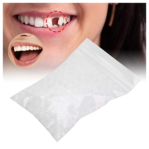 Cuentas de Reparación de Dientes Temporales, Cuenta de Reparación de Dientes, Reparación de Dientes Perdidos por Falta de Dientes Rotos Material de Relleno de Dientes Dentales(0.4oz)