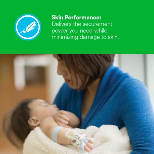 3M™ Micropore™ S Surgical Tape, 2770-2, 2 Inch X 5.5 Yard (2.5 Cm X 5 M), 6 Rolls/Box, 10 Boxes/Case #TOP3