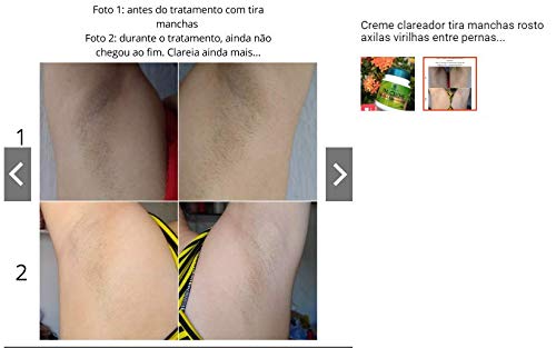 Clareador Virilha, Joelhos, Cotovelos, Joelhos E Axilas