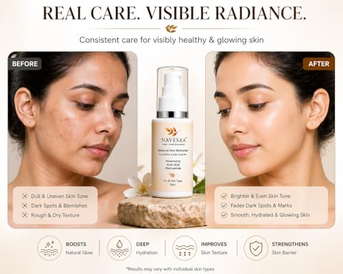 Image of Radiance Dew Moisturizer with Kojic Acid & Niacinamide for Glowing Skin | Brightening And Lightweight Hydrating Face Moisturizer for Men & Women | For All Skin Types | 50 ml