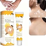 Beevenom Vitiligo Treatment Cream with Bee Venom for All Skin Types (1 Piece)