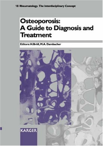 Osteoporosis: A Guide to Diagnosis and Treatment (RHEUMATOLOGY)      First Edition