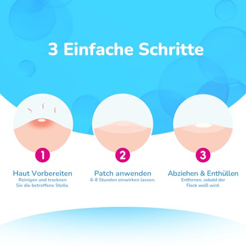 Pickel Patch Pimple Patches Acne Patch 72 Stück Anti Pickel Patches Unsichtbar Tag & Nacht with Salicylic Acid，Niacinamide，Centella Asiatica，Zwei Größen 10 mm，12 mm