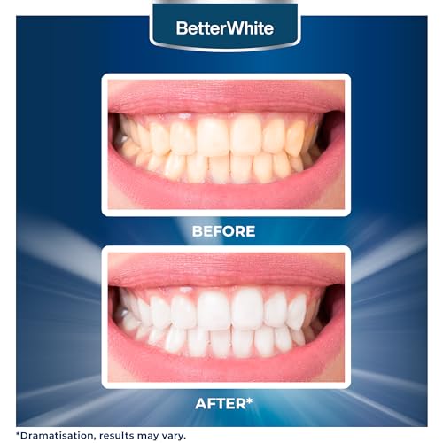 teeth whitening powder - hydroxyapatite remineralizing non-sensitive formula - dentist-approved tooth stain remover amp polisher - fluoride-free 30 grams