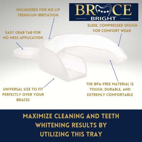 Braces Cleaner Foam Teeth Whitening Kit- Use W/ Trays, Retainer, Aligner For Teeth Whitening With No Sensitivity - Safe For Wax, Flossers, Toothbrush, Dentures - Orthodontic Care By Bracebright #TOP2
