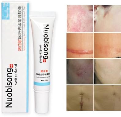 15g Reduce Post Acne Spot Pimple Scars Keloid Removal Cream Gel for Skin Facial Care Treatment