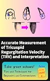 Accurate Measurement of Tricuspid Regurgitation Velocity (TRV) and Interpretation: Take great echoes! Tips and Techniques for Beginners and Intermediates