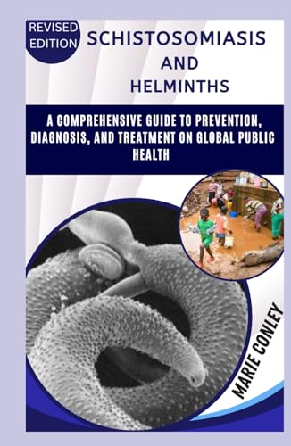 SCHISTOSOMIASIS AND HELMINTHS: A COMPREHENSIVE GUIDE TO PREVENTION, DIAGNOSIS, AND TREATMENT ON GLOBAL PUBLIC HEALTH