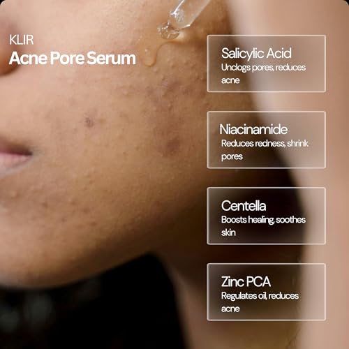 Image of Klir Acne Pore Serum for acne, blackheads, open pores, excess oil with 2% Salicylic Acid, 2% Niacinamide, Zinc, Centella Asiatica(30ml)