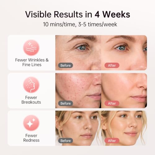 Image of Red Light Therapy for Face - Cordless LED Face Mask with 4 Light Modes (NIR 850nm, Red 630nm, Blue, Amber), 272 LEDs, 10-Min Timer, Rechargeable for Glowing Skin at Home (Pink) | 4 Modes, 272 LEDs, 27mW /cm, Full Face Coverage, 10-Min Timer, Home Use, visible results in 4 Weeks, Birthday Gift, Pink