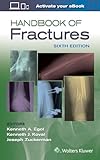 Handbook of Fractures
