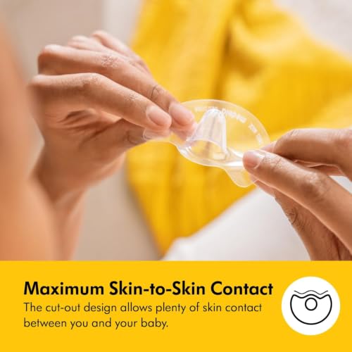 Medela Silicone Contact Nipple Shields, Soft Ultra-Thin Design, Made Without BPA, 1 Pack of 2 Shields (20 mm) and Case