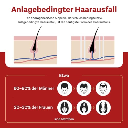 4. Bild von Minoxidil DoppelherzPharma 20mg/ml (2%) Lösung zur Anwendung auf der Haut (Kopfhaut) – Arzneimittel zur Behandlung von anlagebedingtem Haarausfall bei Frauen (3x 60ml)