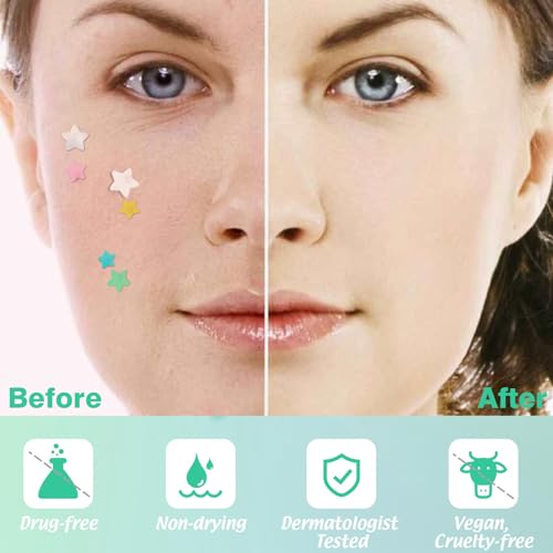 Pimple Patches For Face 240 Counts Hydrocolloid Acne Patches Colorful Star Pimple Patches Zit Patches Acne Dots Blemish Patches with Salicylic Acid Tea Tree Oil Calendula Oil 3 Sizes Acne Patches