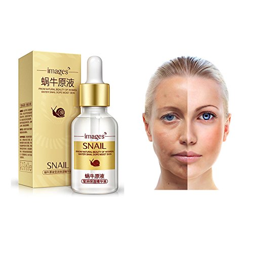 Preisvergleich Produktbild samLIKE Facelifting Serum Creme Essenz Hautpflege Anti Aging Eternal Hyaluronsäure (Gold)