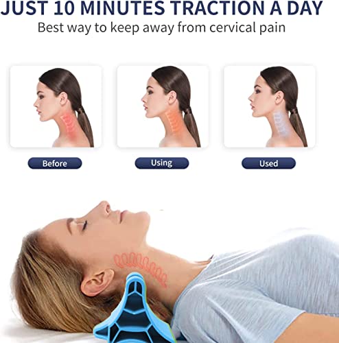 Xemz Portable Trigger Point Massager