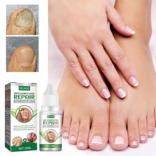 Reparação de unhas | Fortalecedor de unhas para unhas finas | Fortalecedor de unhas para unhas danif