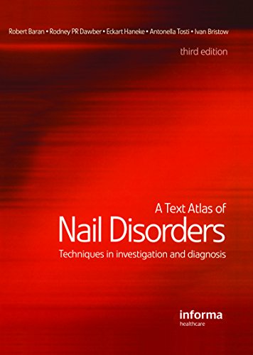 A Text Atlas of Nail Disorders: Techniques in Investigation and Diagnosis (English Edition)