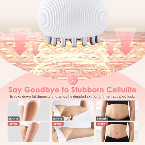 Image of HANNEA Lymphatic Drainage Massager & Anti-Cellulite Tool for Legs, Arms, Belly Sculpting Machine with Microcurrent, Light, Heat, Vibration Reduces Stretch Marks Rechargeable White