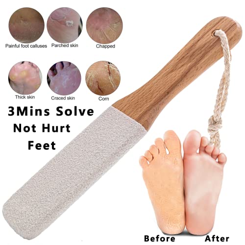 Kinepi Callus Remover Foot Scrubber Colossal Foot File Foot Care And Foot Exfoliator Foot Rasp Pedicure Tools Pumice Stone For Feet,Remove Corn Hard Skin Dead Skin For Use In Shower Foot Scraper Kit #TOP2