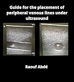 Guide for the placement of peripheral venous lines under ultrasound