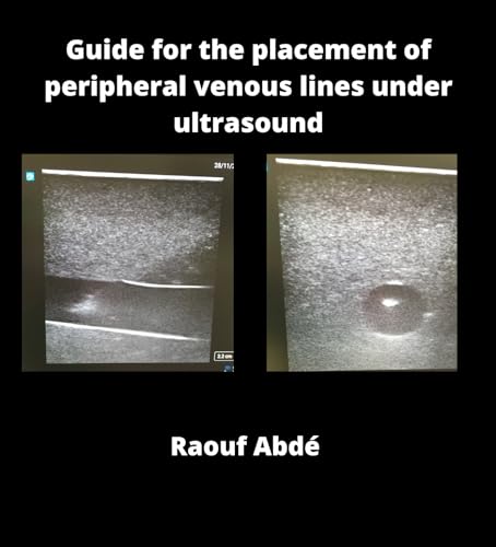 Guide for the placement of peripheral venous lines under ultrasound