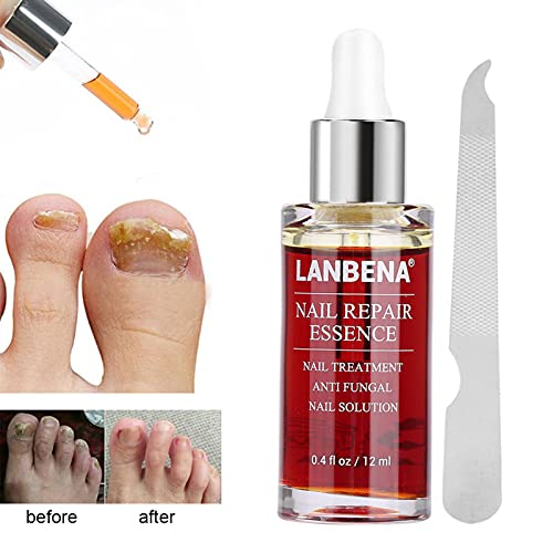 Nail Repair Essence, 12 Ml, Natural Powerful, Anti-Fungus Nail Treatment Effective Repair Solution. #TOP6