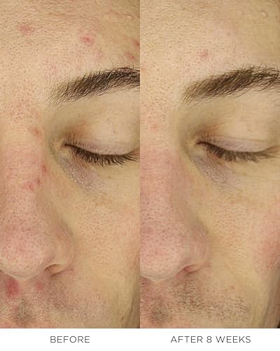 Noble Panacea Overnight Chronobiology Peel, view 4