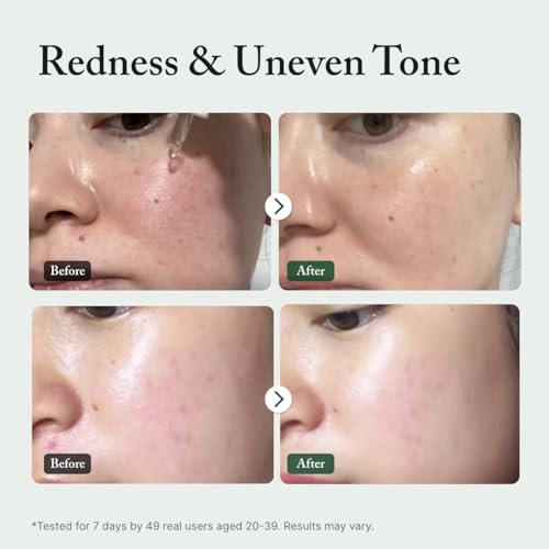 Image of AROMATICA Azelaic Acid 10% Serum 1.01 fl oz