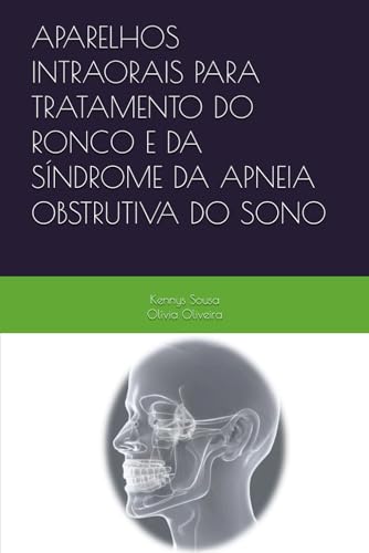 APARELHOS INTRAORAIS PARA TRATAMENTO DO RONCO E DA SÍNDROME DA APNEIA OBSTRUTIVA DO SONO (Portuguese Edition)