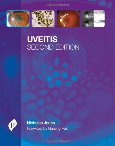 Uveitis by Nicholas P. Jones (2012-12-18)